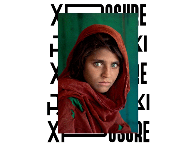 Xposure Case Thumbnail